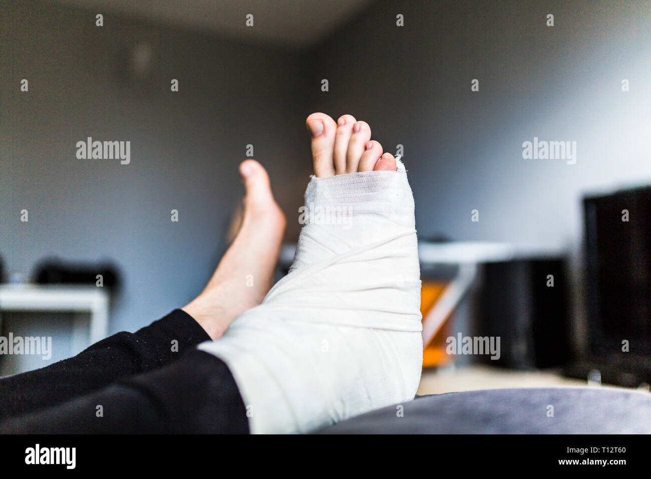 Resting with a broken leg at home Stock Photo Alamy