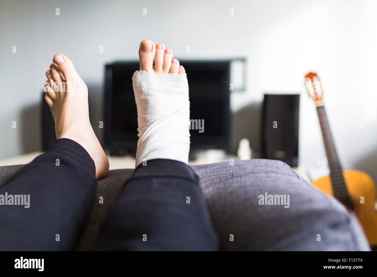 Resting with a broken leg at home Stock Photo Alamy