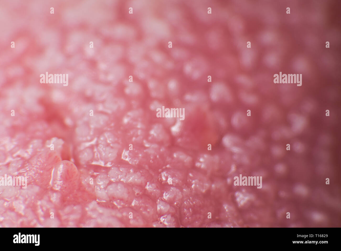 Candida albicans hi-res stock photography and images - Alamy