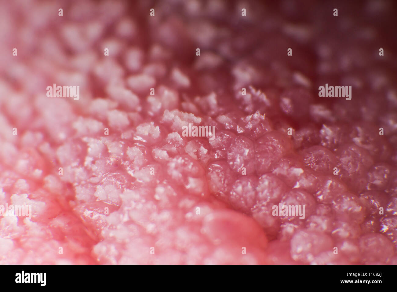 Super macro surface of tongue candidiasis overgrowth Stock Photo
