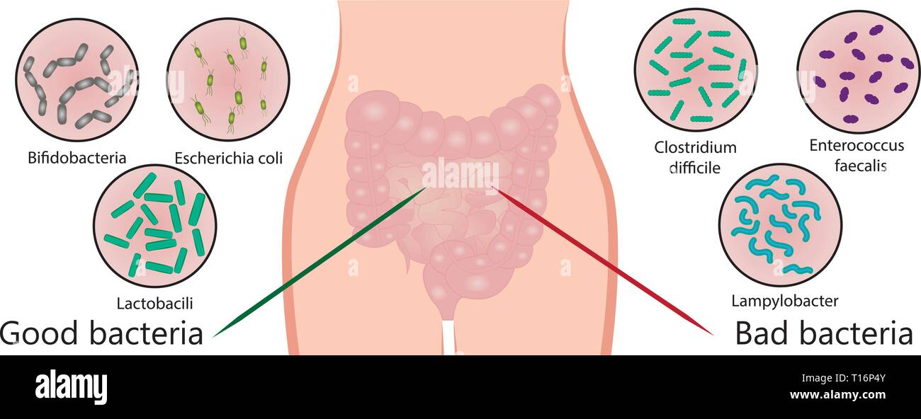 Enterococcus faecalis что это такое у женщин