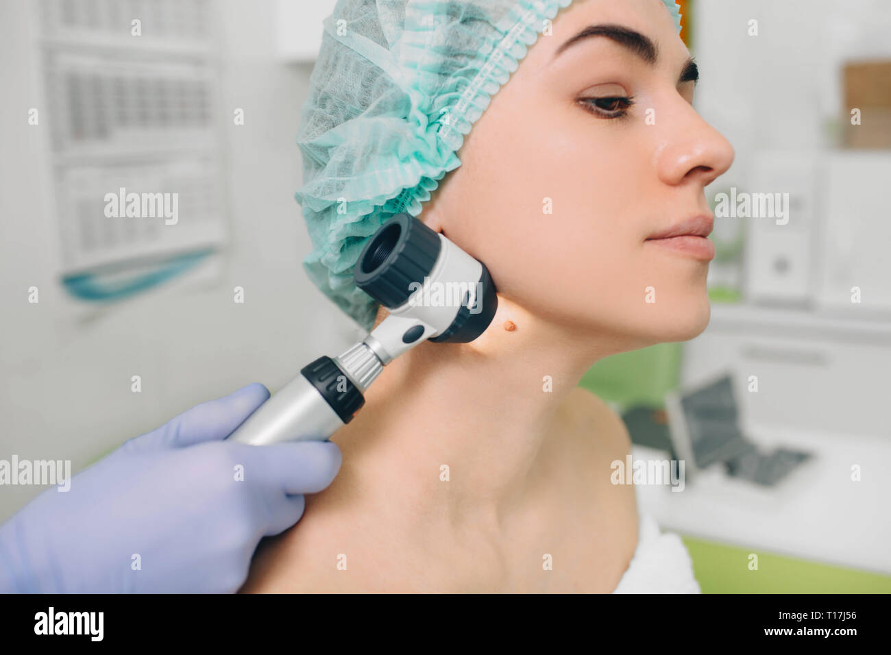 dermatologist exam skin mole on female neck using dermatoscope Stock Photo