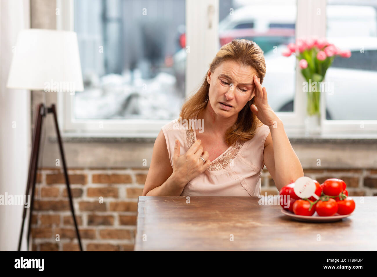 Woman having headache and rash on skin after eating tomatoes Stock Photo