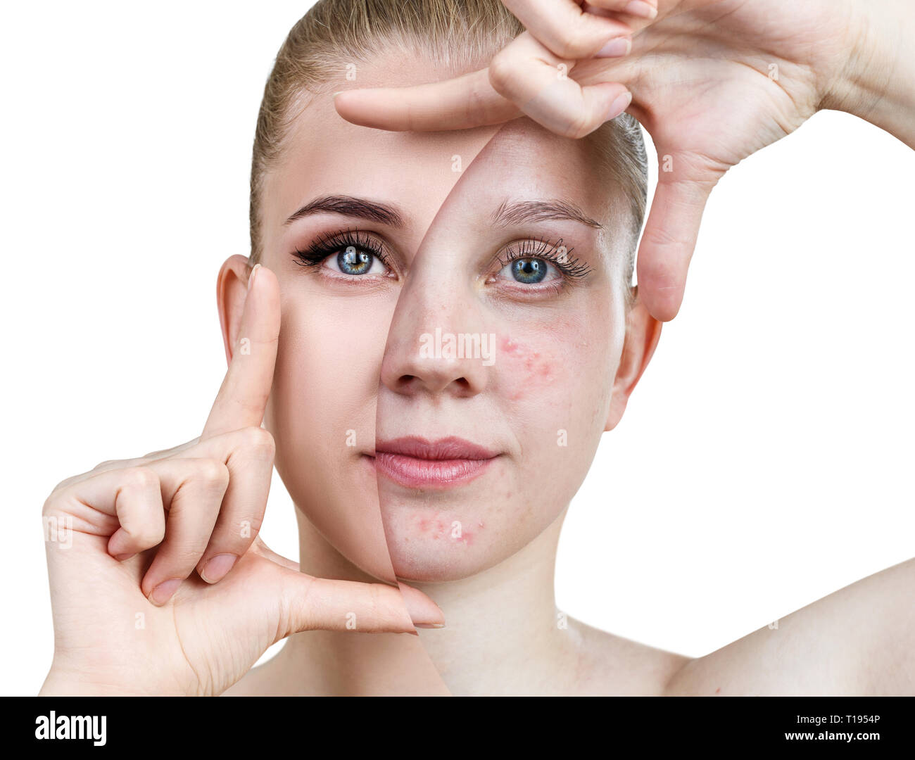 Young woman before and after skin treatment and makeup Stock Photo Alamy