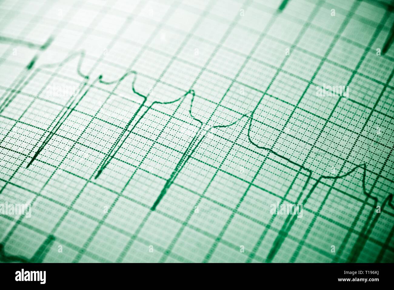 Electrocardiogram Ecg High Resolution Stock Photography and Images - Alamy