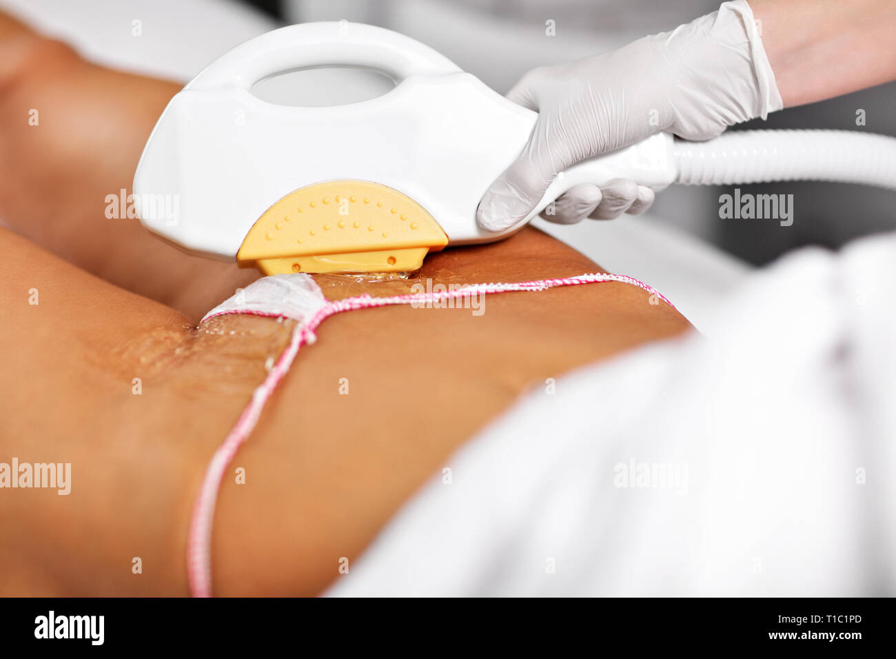 Picture Of Beautician Giving Epilation Laser Treatment To Woman On Bikini  Stock Photo - Alamy