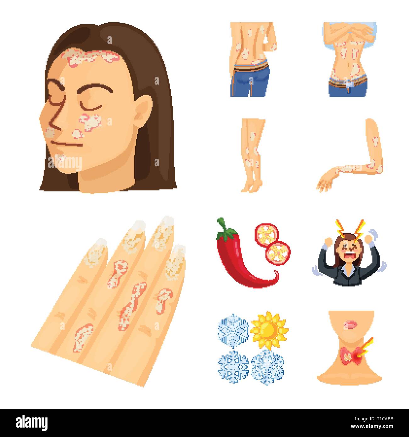 psoriasis,pepper,stress,snowflake,endocrine,skin,body,dermatitis,chili