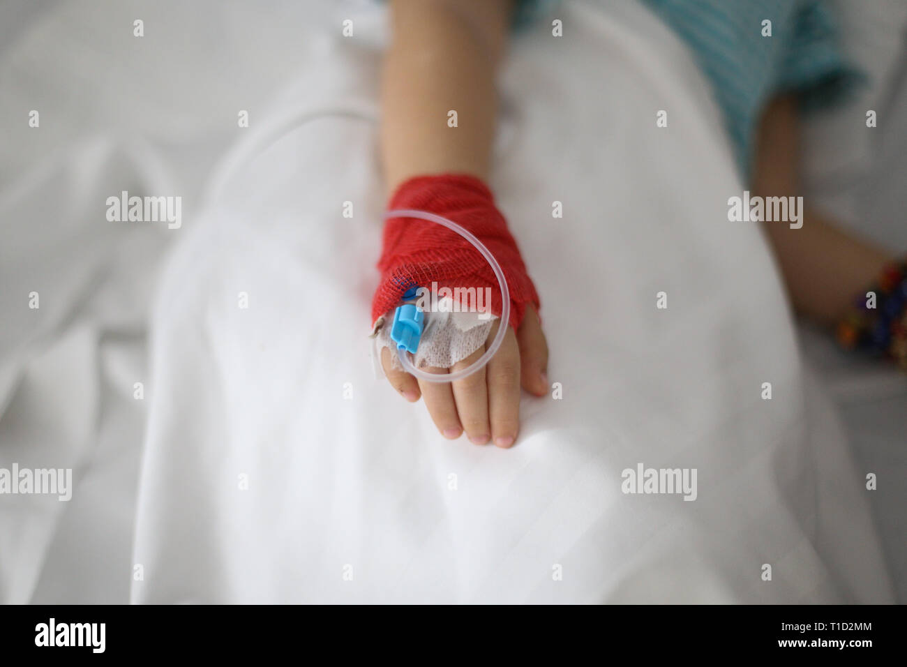 Details with a cannula on the hand of a ill little girl in a pediatric hospital reserve Stock Photo