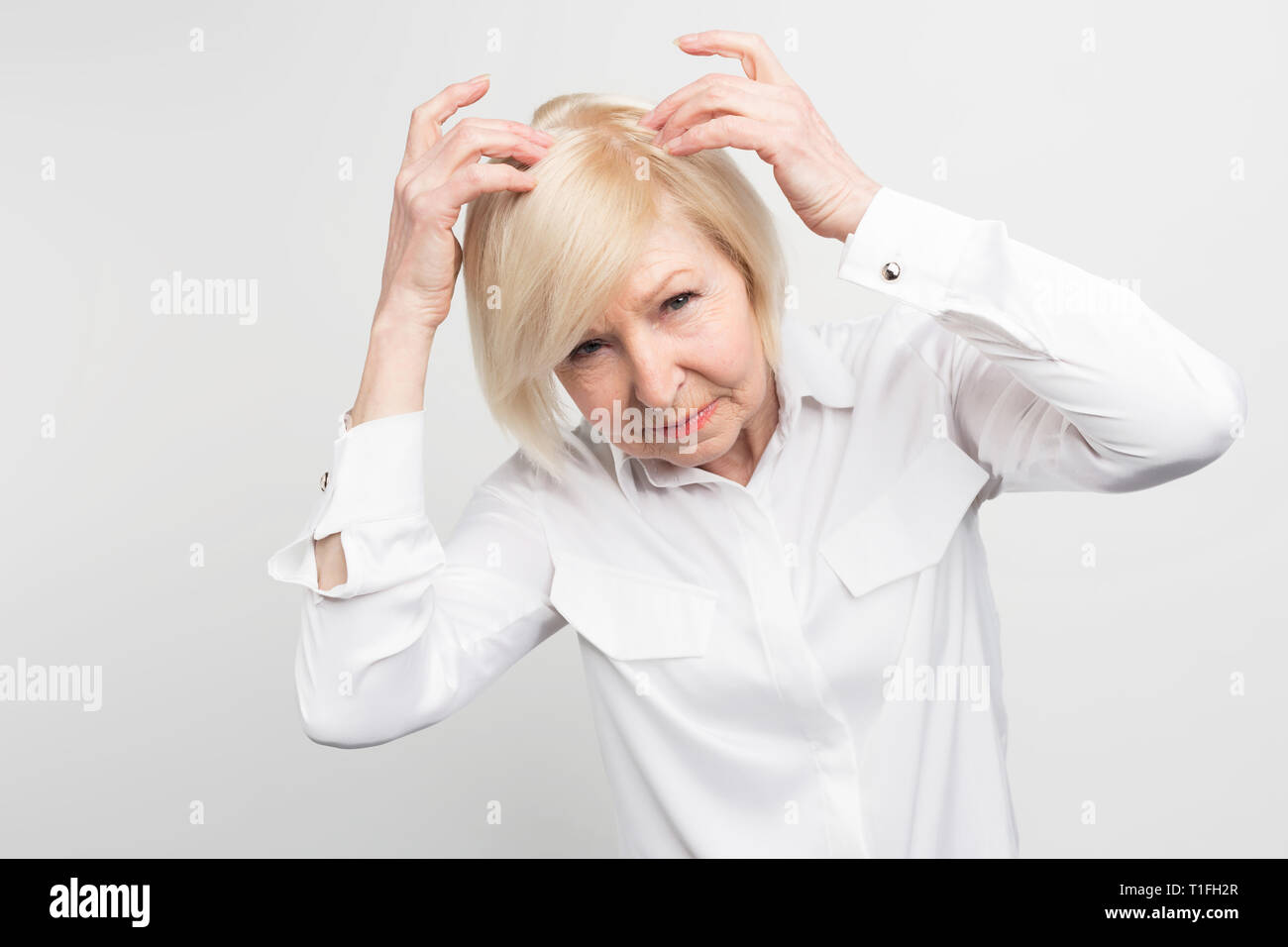 This woman has a problem of loosing hair from her head. She need some treatment. Otherwise she would need to start wearing a wig as soon as possible Stock Photo