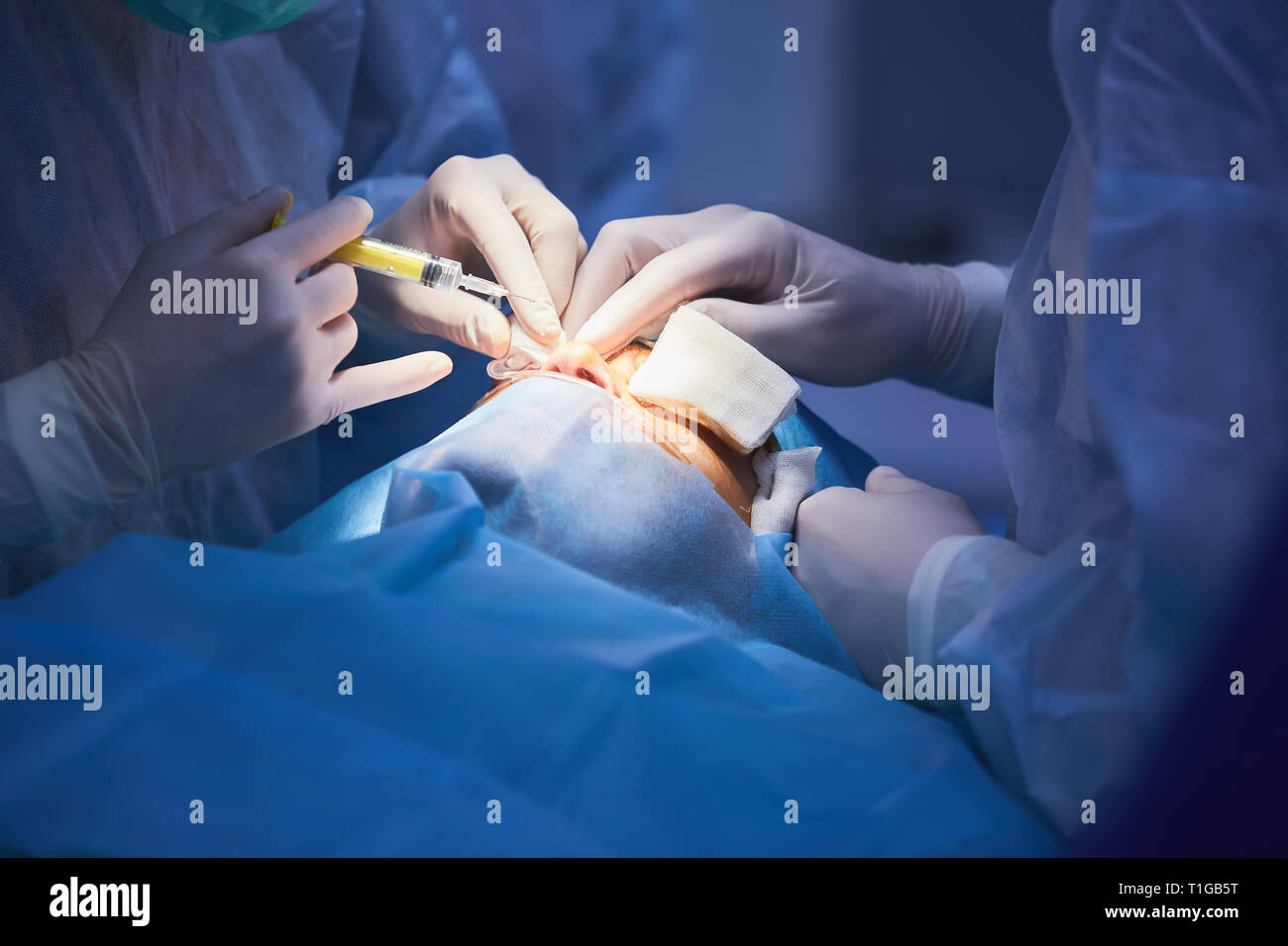 Medical Team Performing Surgical Operation in Modern Operating Room ...