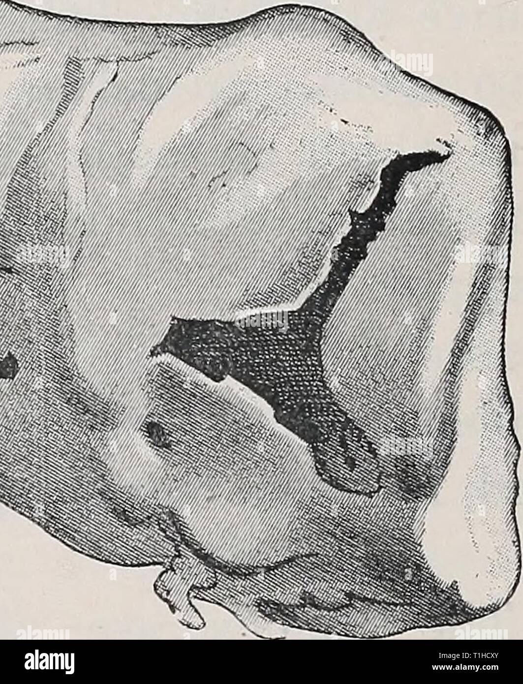 Infective arthritis hires stock photography and images Alamy