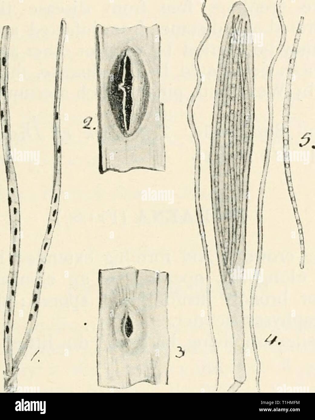 Diseases of cultivated plants and Diseases of cultivated plants and trees  diseasesofcultiv00massuoft Year: [1910?]  LOPHODERMIUM 249 Usually saprophytes on dead leaves or stems. Ascophores often gregarious on bleached spots. Pine leaf cast {Lophoderrtiium pinastri, Chev. =Hyster- ium pinastri, Schrad.) !s the cause of a serious disease to seedling conifers, which results in the leaves being shed; if this occurs for two or three years in succession the trees are killed outright. According to Hartig the disease may frequently be observed even in the first autumn, by the    Fig. 71. — Lophodermi Stock Photo