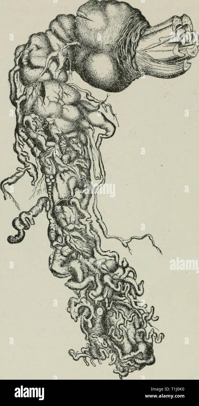 Diseases of plants induced by Diseases of plants induced by cryptogamic parasites; introduction to the study of pathogenic Fungi, slime-Fungi, bacteria, & Algae  diseasesofplant00tube Year: 1897  526 T1II&lt;; PATHOGENIC SLIME-FUNGI. young roots of newly germinated cabbage, turnips, etc. They do this by penetrating the cell-wall, probably that of a hair to begin with, and the malformation ensues. The myxainoebae possess a flagellum and pseudopodia, so that they are fitted for    Fio. 316.—Plasmodio'phora hroxiccK. Effects on Tiiniip grown in Russia. (After Woronin.) different modes of locomoti Stock Photo