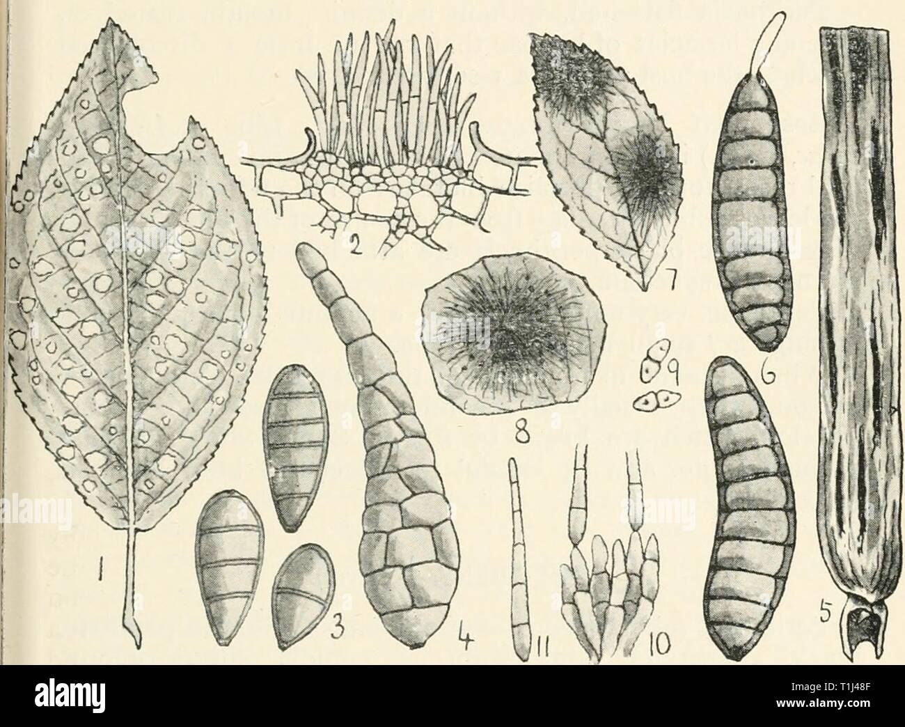 Diseases of cultivated plants and Diseases of cultivated plants and trees  diseasesofcultiv00massuoft Year: [1910?]  DILOPHOSPORA 427 DILOPHOSPORA (Desm.) Perithecia crowded, immersed in a crustaceous weft of hyphae or stroma; spores fusiform, septate, hyaline, furnished at each end with several simple or branched, delicate hairs. Wheat ear fungus {Dilophospora gramtnis, Desm.) some- times attacks ears of wheat and arrests the development of    Fig. 132. — Cylindrosporiiirn padi. i, spots caused by fungus on a plum leaf; 2, section through a pustule of conidia of same; 3, conidia of Exosforium Stock Photo