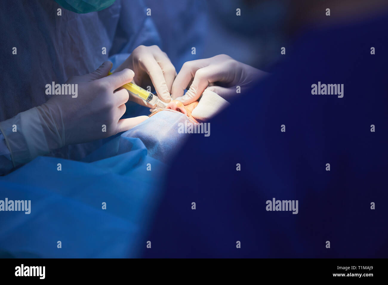 Medical Team Performing Surgical Operation in Modern Operating Room ...