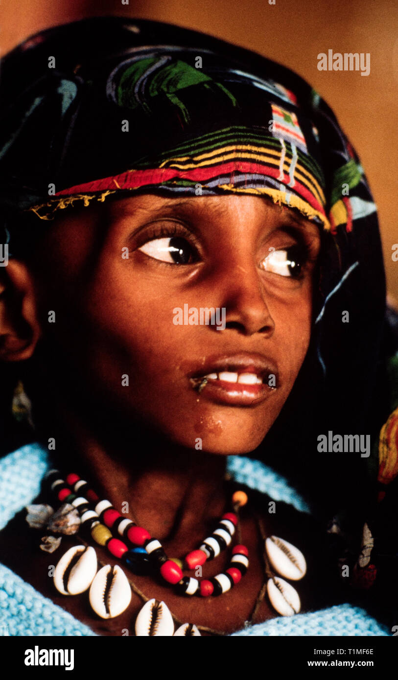 Sudan during the famine period of May-June 1985. Girba 2 Refugee Camp. This picture scanned in 2018 Stock Photo