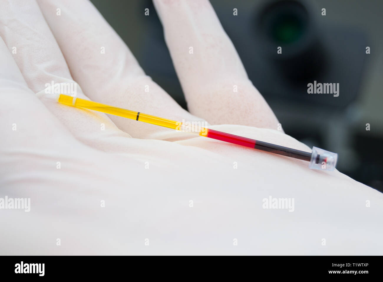 scientist holding in his hand a centrifuged blood sample with hemolysis