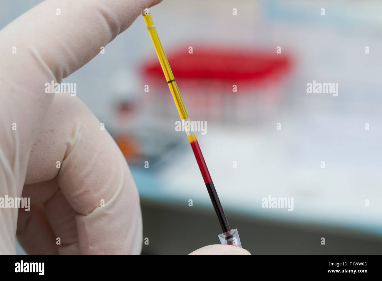 scientist holding in his hand a centrifuged blood sample with hemolysis