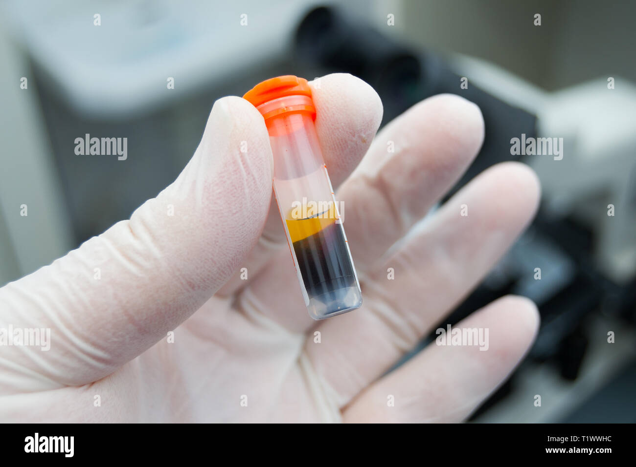scientist holding in his hand a centrifuged blood sample with hemolysis