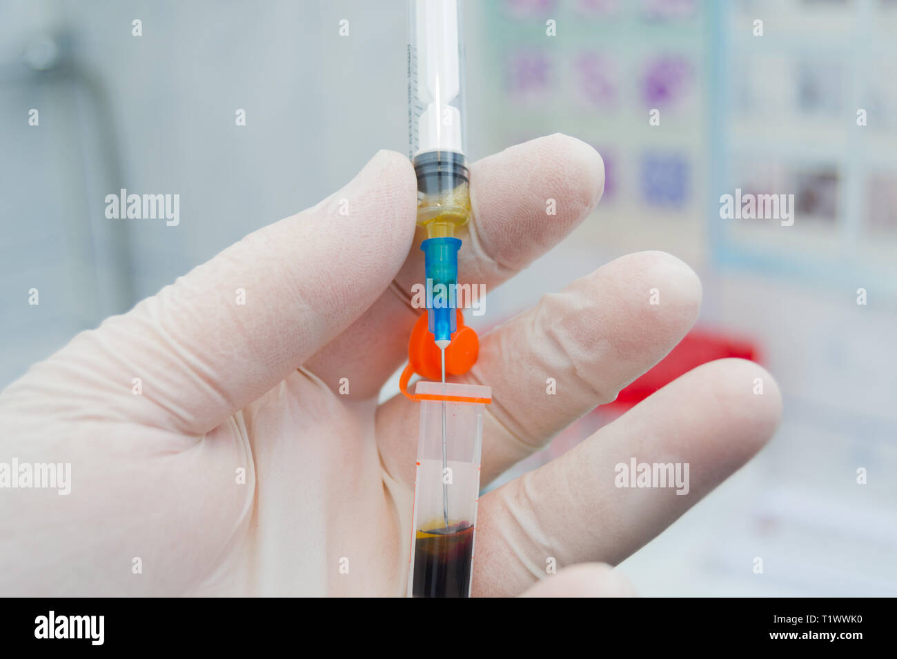 scientist holding in his hand a centrifuged blood sample with hemolysis