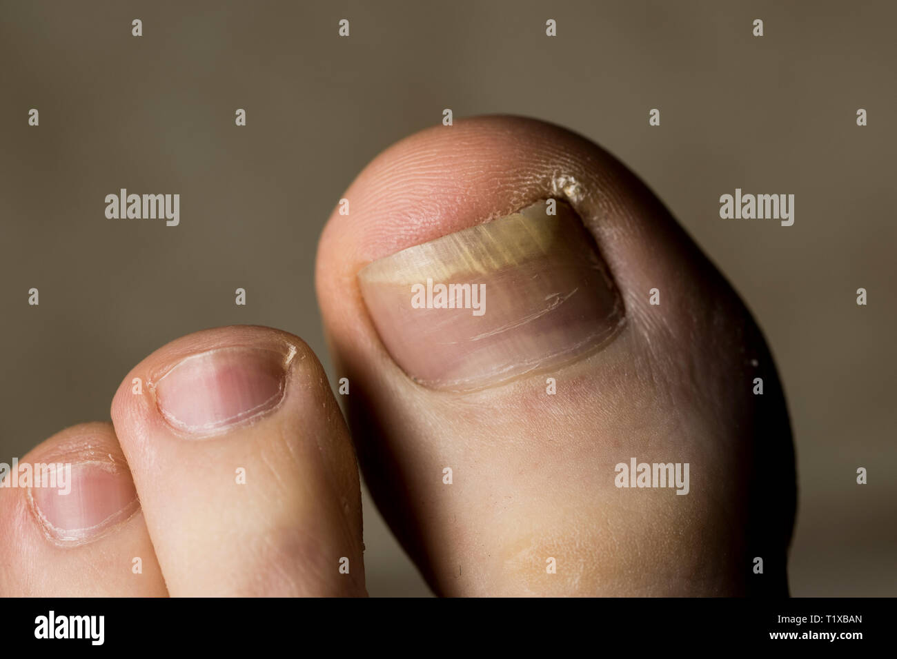 Losing shoe hires stock photography and images Alamy