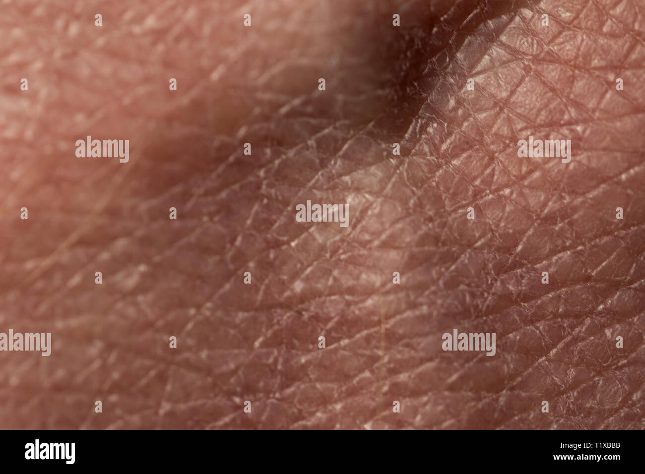 Skin close up. Dry human skin under microscope with eczema damage. Cracked  dry skin damage Stock Photo - Alamy