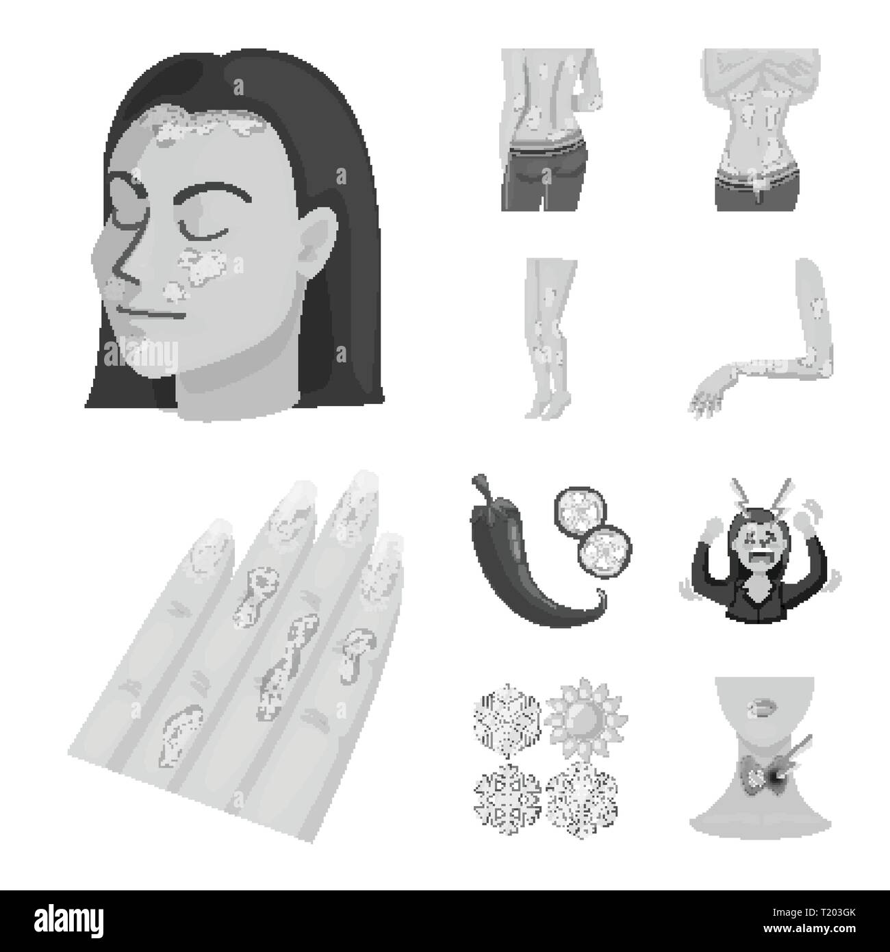 psoriasis,pepper,stress,snowflake,endocrine,skin,body,dermatitis,chili