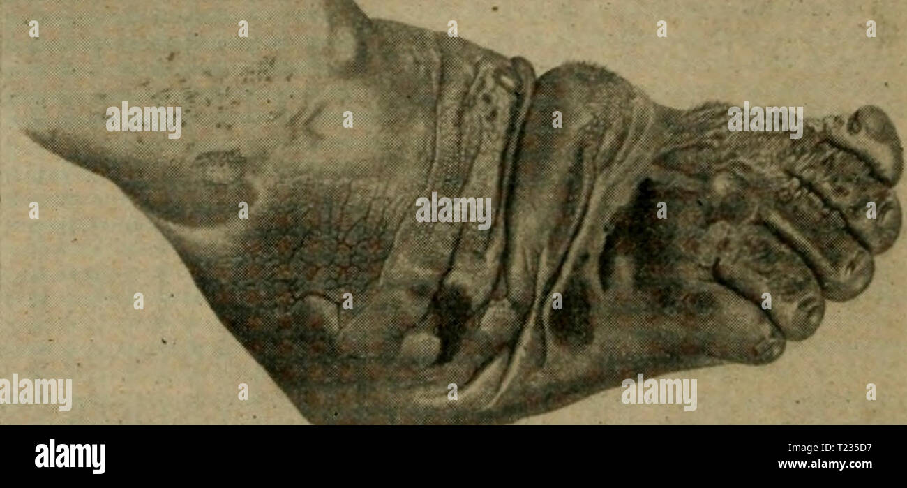 Archive image from page 143 of Die vergleichende Pathologie der Haut Stock Photo