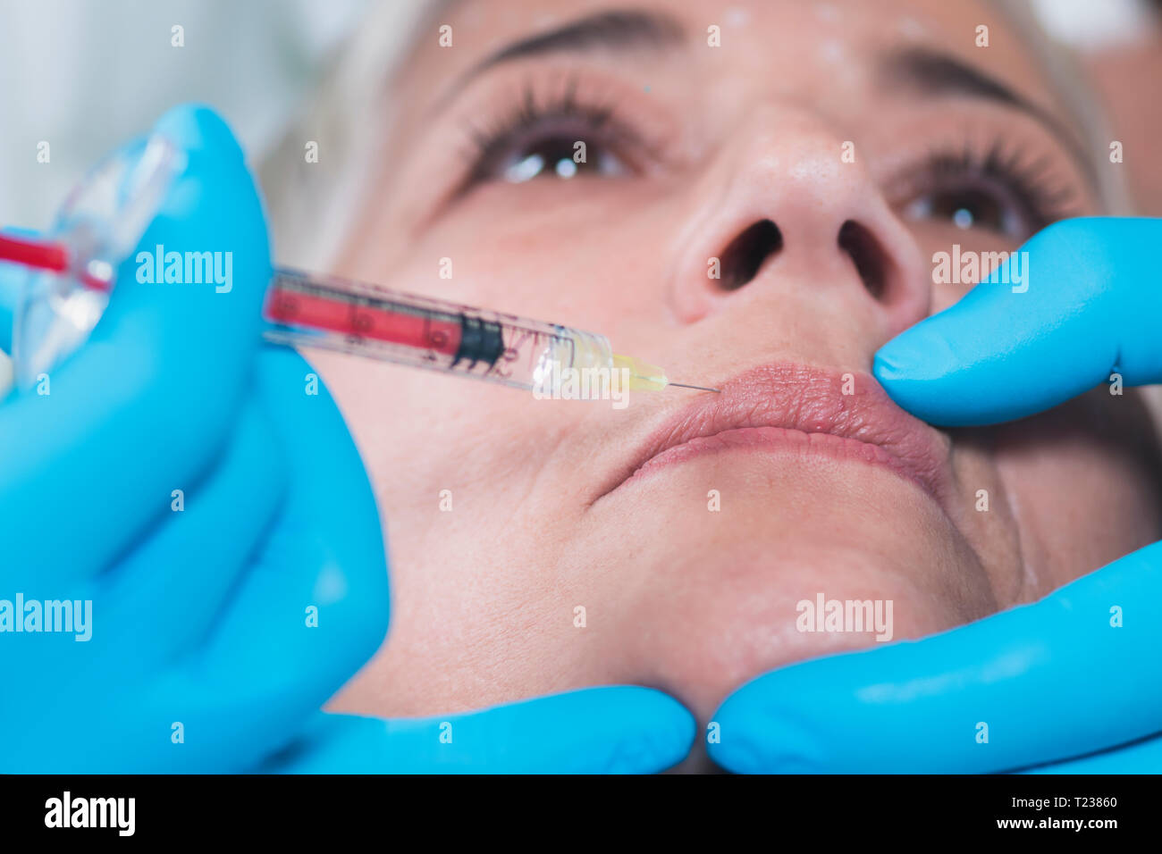 Hyaluronic injections. Mature woman receives hyaluronic acid injections