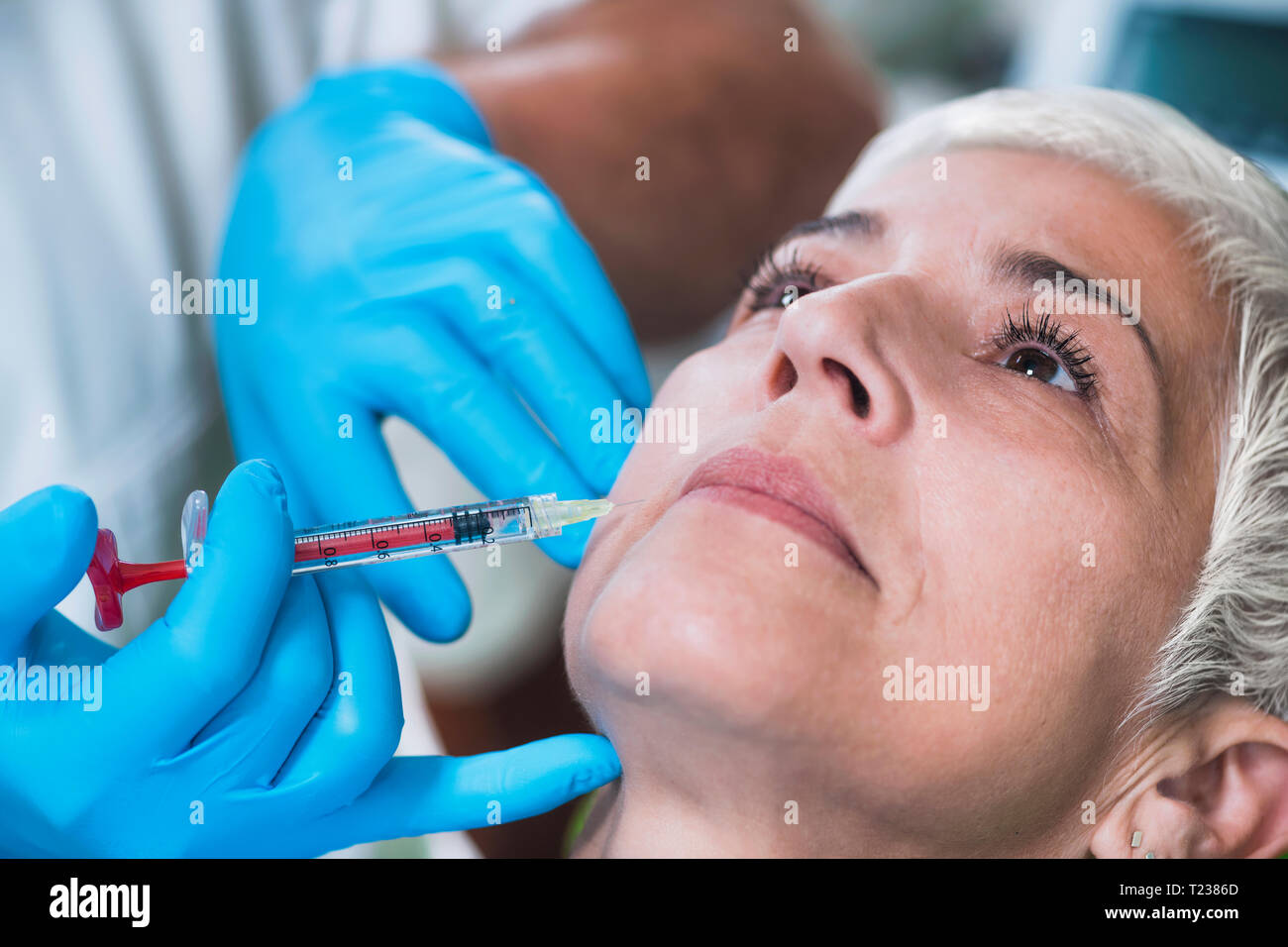 Hyaluronic injections. Mature woman receives hyaluronic acid injections