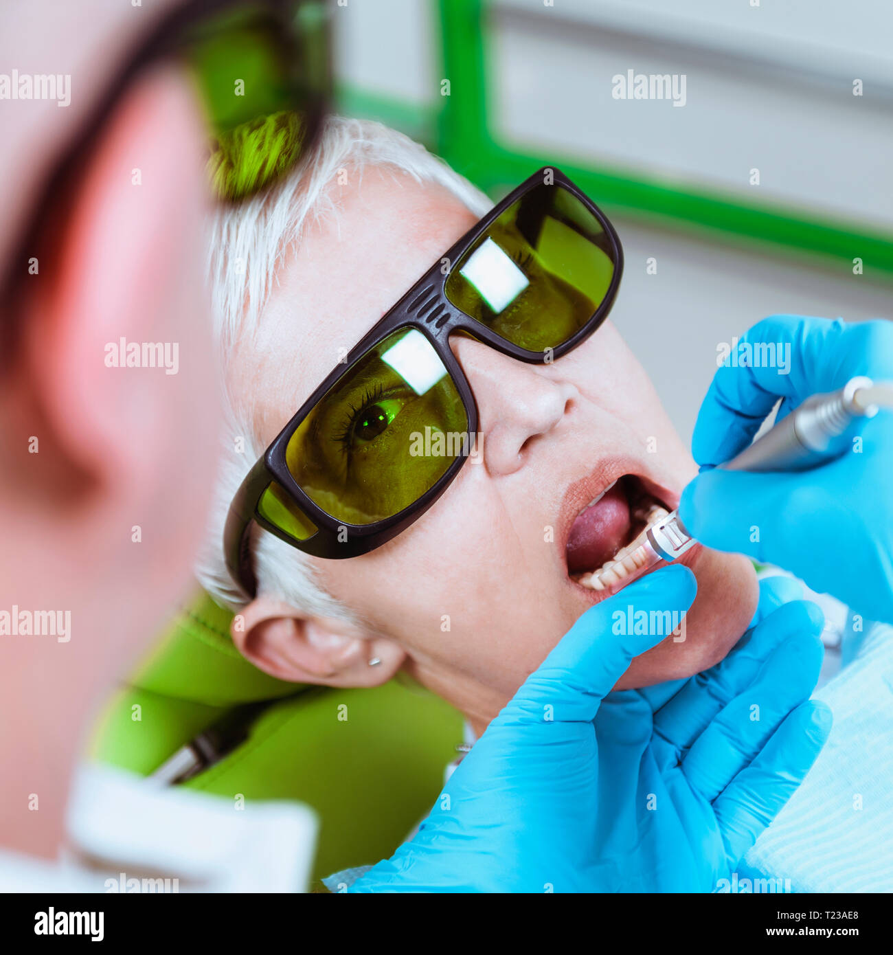 Laser teeth whitening Stock Photo Alamy