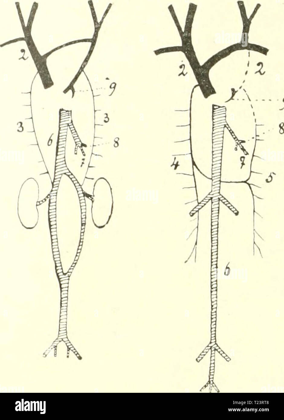 Archive image from page 253 of Die säugetiere Einführung in die Die säugetiere. Einführung in die anatomie und systematik der recenten und fossilen Mammalia  diesugetiereei00webe Year: 1904  - 9    Fig. 191. Entwickelung des Venensystems in vier Stadien. / Ductus Cuvieri; 2 Venae cardinales anteriores (Venae jugulares resp. vordere Hohlvenen); 3 Venae car- dinales posteriores; 4 Vena azygos; 5 Vena hemiazygos; 6 Vena cava posterior; 7 Vena umbilicalis; 8 Vena hepatica; 9 Vena corouaria cordis. Die vorderen Kardinalvenen, auch primitive Jugularvenen genannt, teilen sich und empfangen in ihrem  Stock Photo