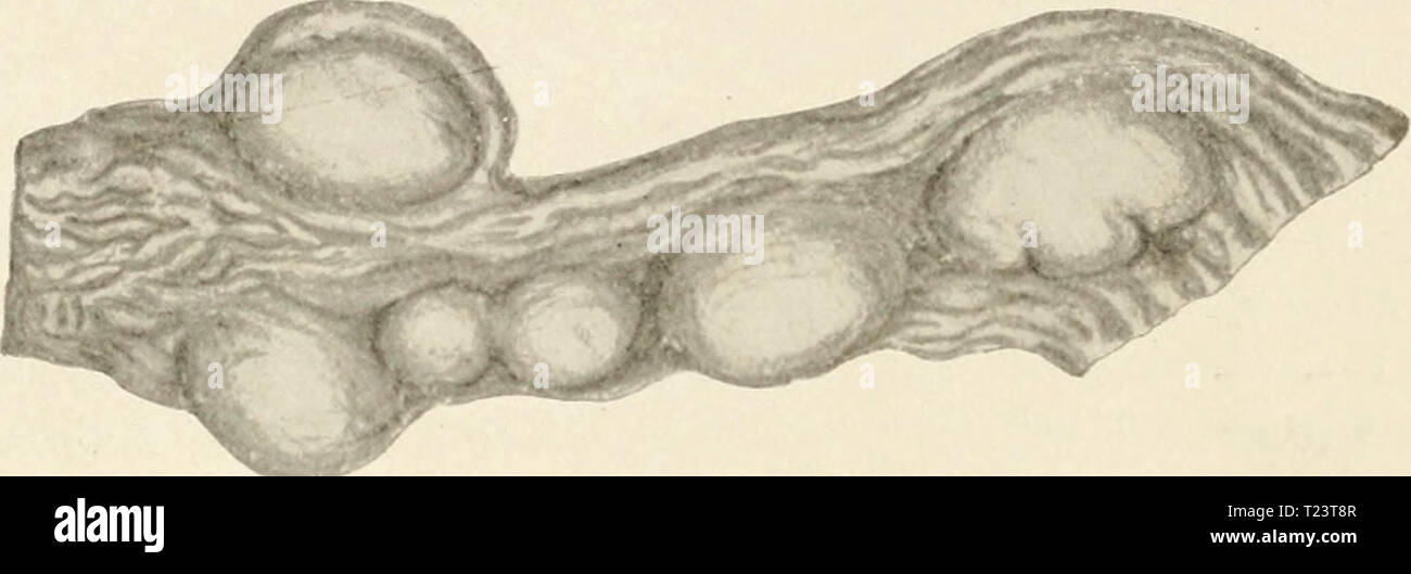 Archive image from page 261 of The pathology and differential diagnosis The pathology and differential diagnosis of infectious diseases of animals  differentpathology00moorrich Year: 1908  238 OVIXE CASEOUS LYMPH-ADENITIS § 170. Morbid anatomy. The principal lesions are confined, according to the various descriptions, especiallj' that by Norgaard and Mohler, to the lymphatic glands. In many cases only a single gland is affected. The relative frequency with which the various glands become the seat of the lesions    Fig. 57. The leg of a rabbit slio-unng enlarged glands after inoculation Ti'itli Stock Photo