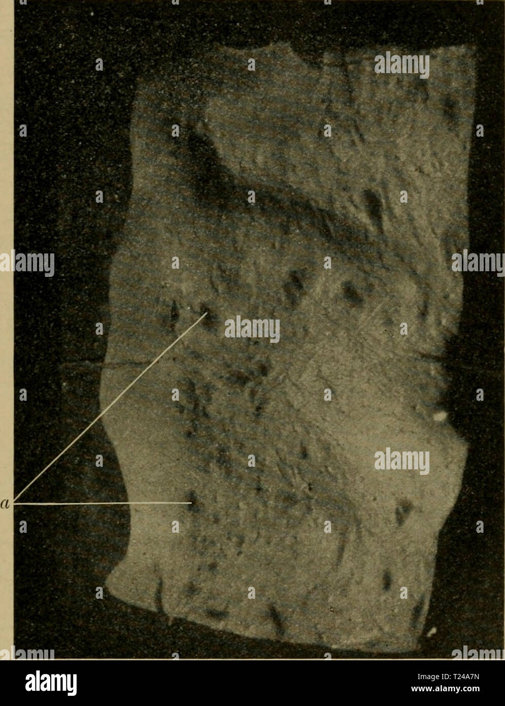 Archive image from page 460 of Die vergleichende Pathologie der Haut Die vergleichende Pathologie der Haut  dievergleichende00hell Year: 1910  Schrotausschlag. 441 Fällen nicht beobachtet. Die Farbe schwankt von bleigrau bis blauviolett; anfangs zeigen die Bläschen jedoch eine blaßgelbe, rostrote bis braune Tingierung. Bei älteren Gebilden fällt der Perlmutt erglänz auf. Die Bläschen sind mit trüber röt- licher Flüssigkeit gefüllt. Im Zentrum finden sich zwiebelartig geschichtete Massen. Meist sielit man in den größeren Bläschen 2—3 Borsten, deren Wurzel in der Zystenwand liegt, während der Sc Stock Photo