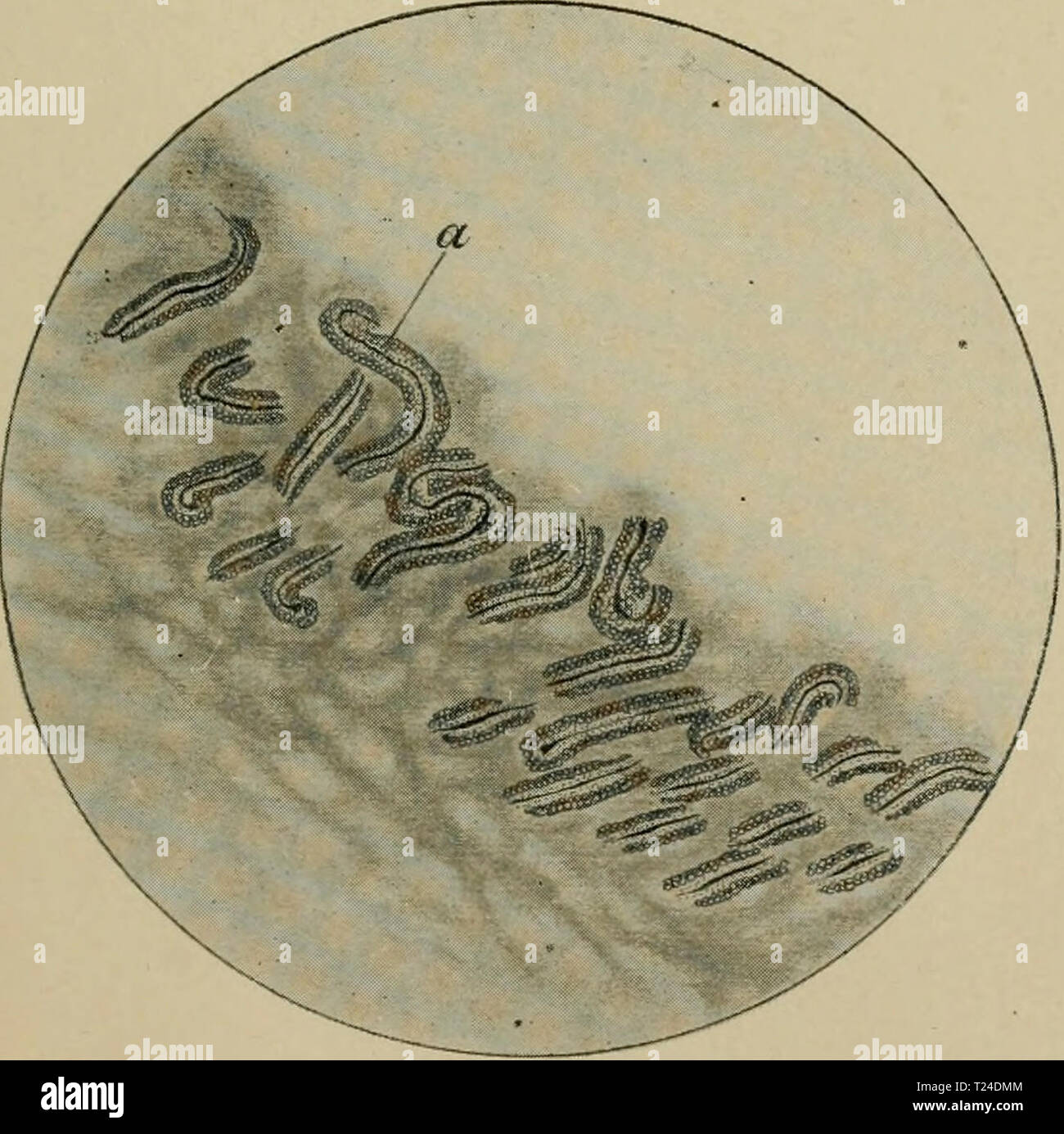 Archive image from page 688 of Die vergleichende Pathologie der Haut Die vergleichende Pathologie der Haut  dievergleichende00hell Year: 1910  Monilithrix. a Haar des Menschen, h Haarspiralcn und Haarspindeln des Pferdes (nach Bonnet). 1 Aeußere Wurzelscheide, 2 Haarspindein, 3 Haarspirale, 4 Innere Wurzelseheide. Ratte. Ilypütrichosis cystica acquisita. Zvstenbilduns der Haarfollikel. Figur 3.    Rind. Haarwaehstum bei Trichophy-tia profunda. Die Skizze soll die eigentümliche Aenderung der Wachstumsrichtung der Haare zeigen; bei a Sporen im Haare. Figur 4. *W -ip Stock Photo