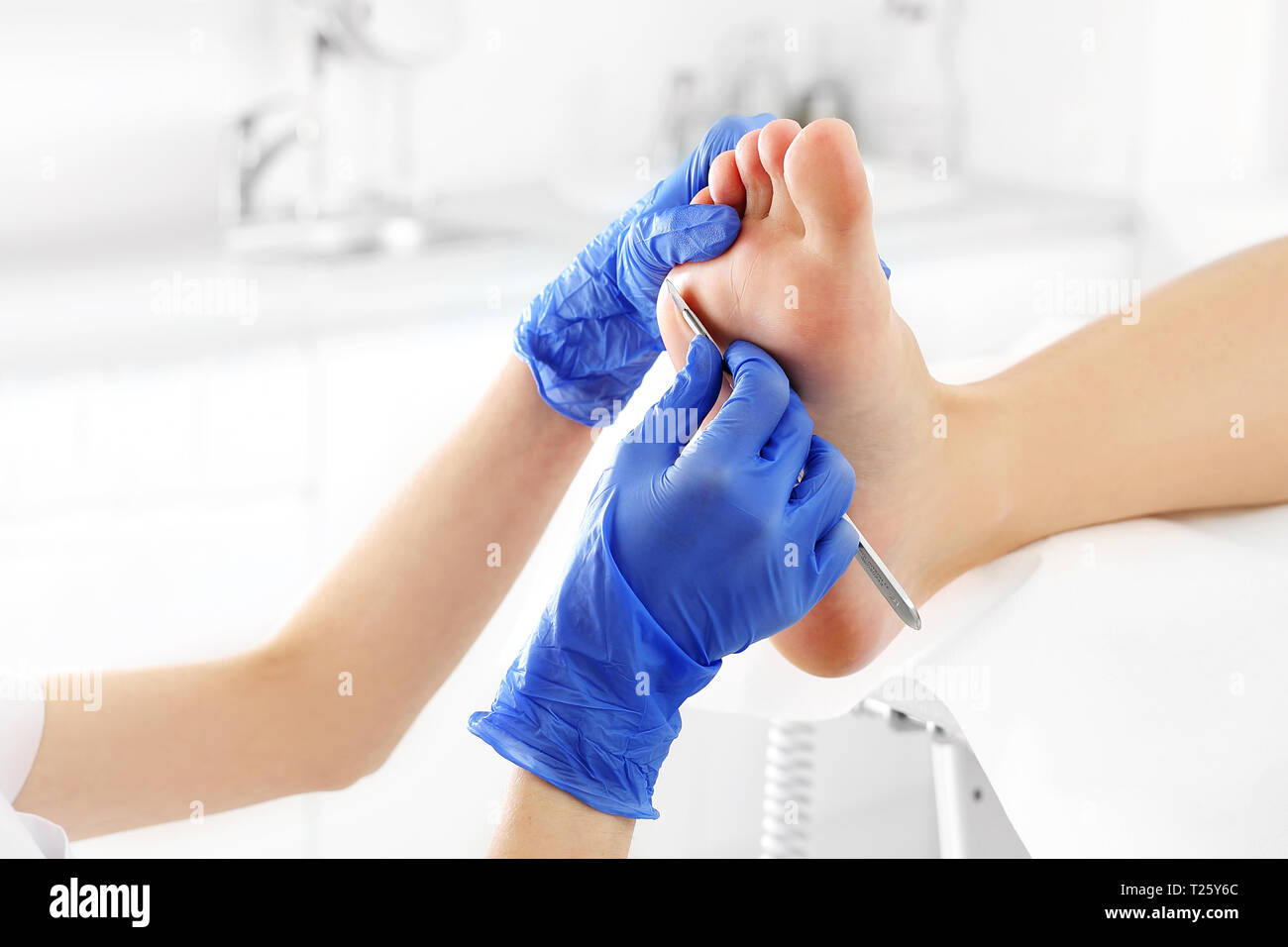 Podiatry. Removing calluses with a scalpel at the beautician. Stock Photo