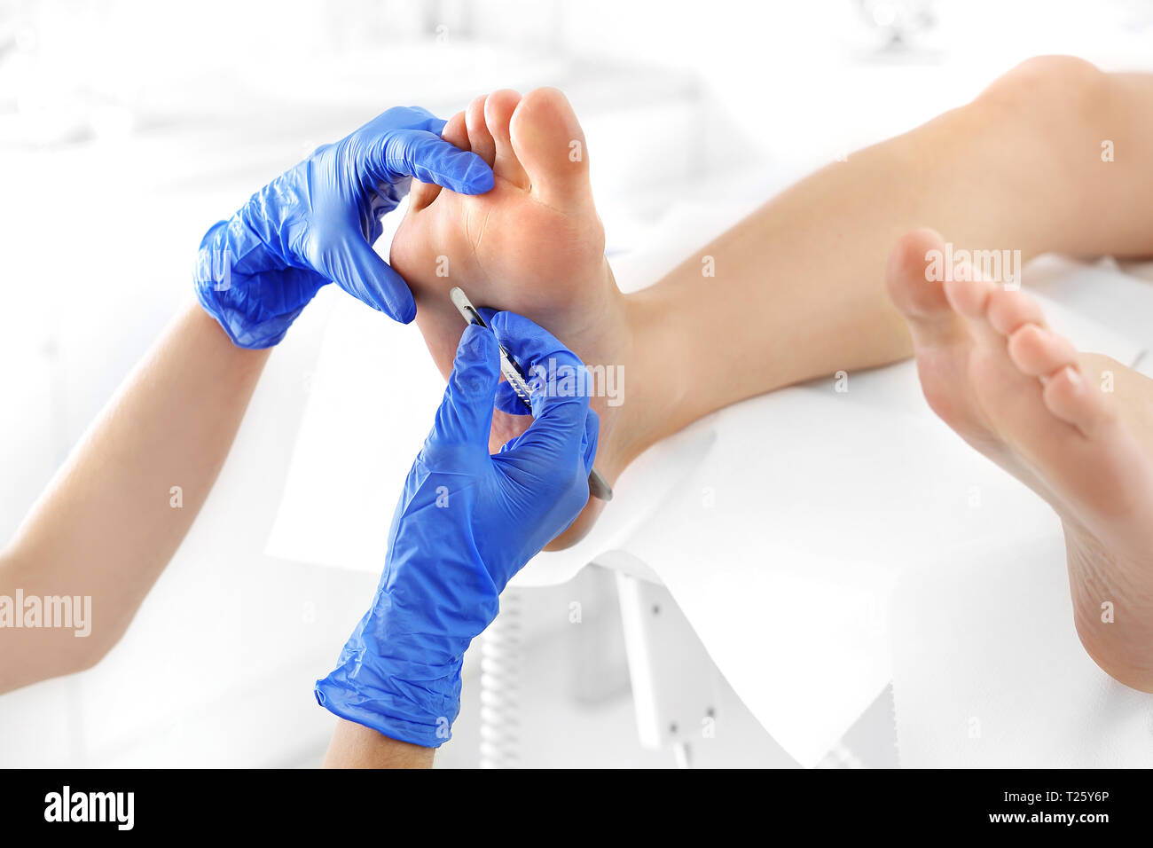 Podiatry. Removing calluses with a scalpel at the beautician Stock Photo Alamy