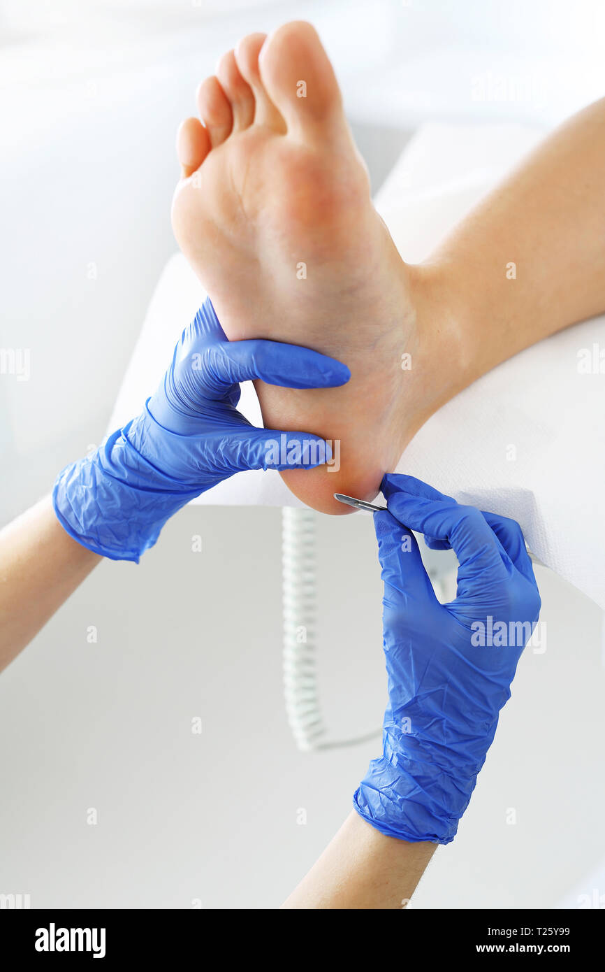Podiatry. Removing calluses with a scalpel at the beautician Stock Photo Alamy