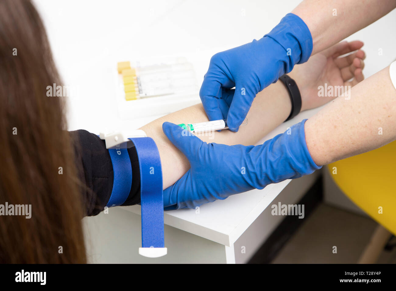 blood sampling from a patient's vein in the laboratory. AIDS and