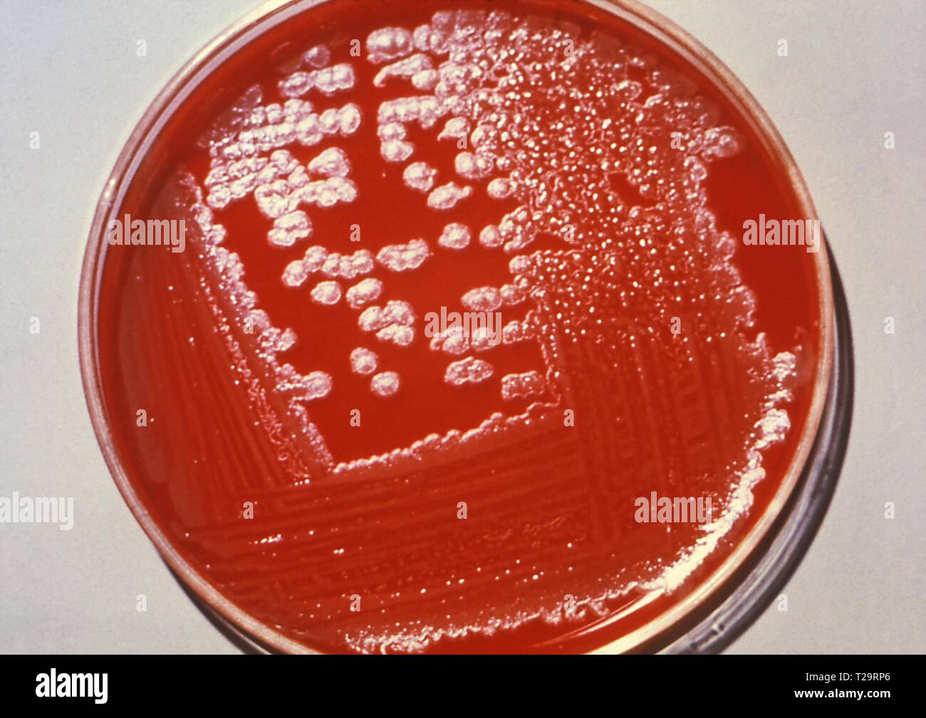 Bacillus Anthracis