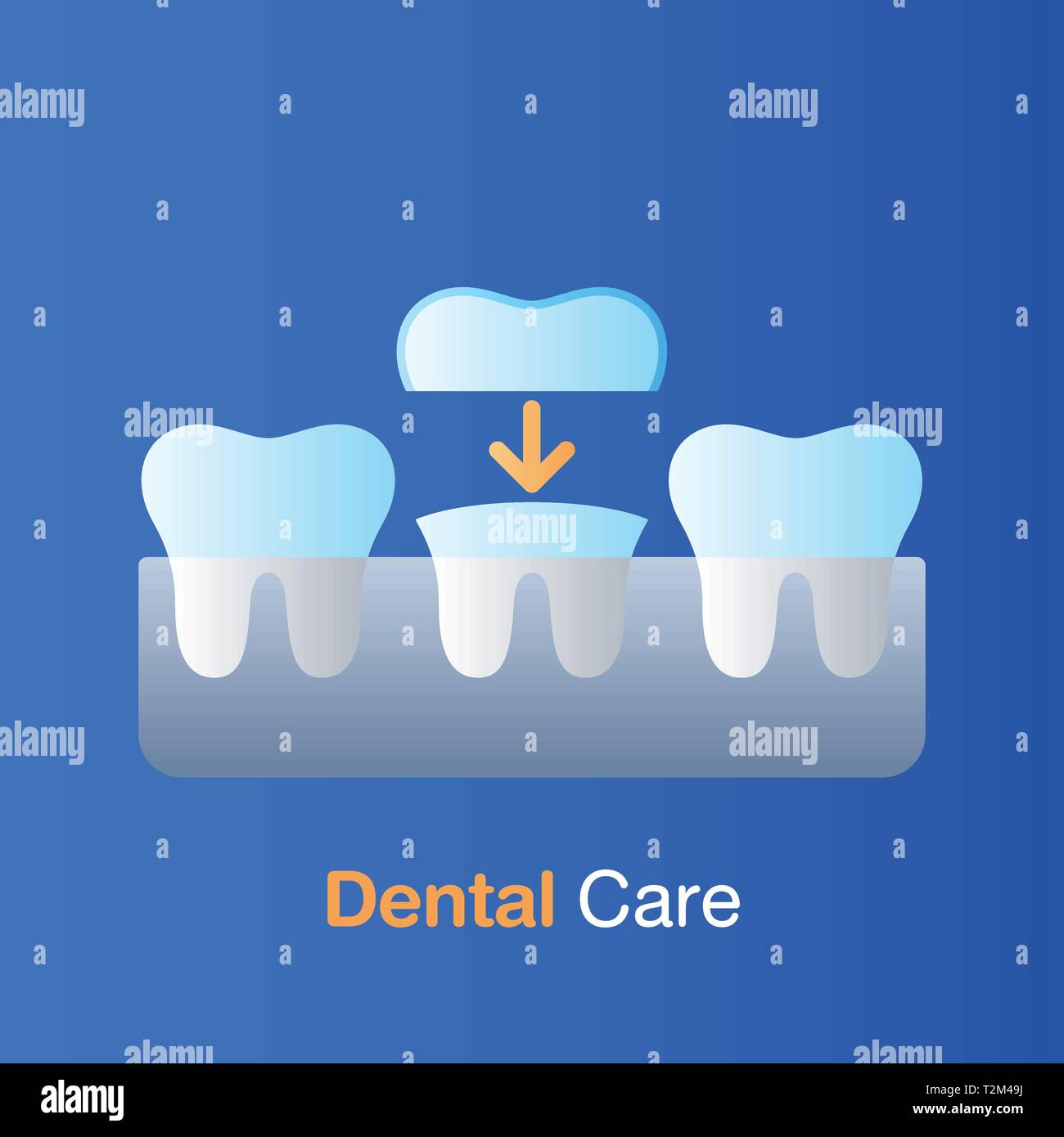 Dental care concept. Implant dentistry, prevention, check up and dental treatment. Vector illustration. Stock Vector