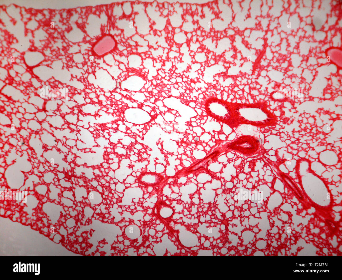 Lung tissue. Stock Photo