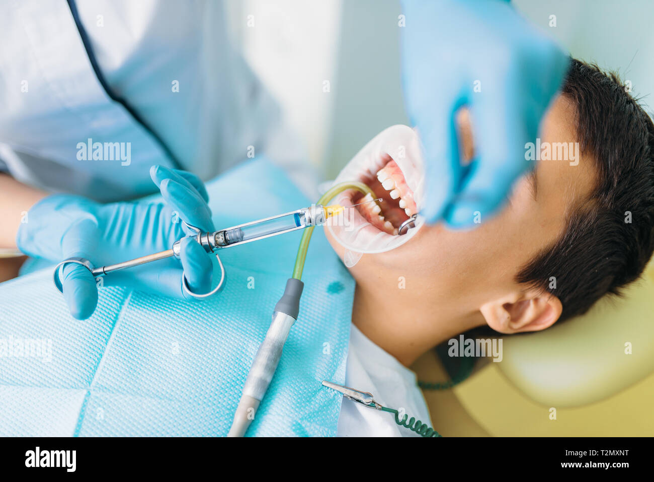 Seal installation process, pediatric dentistry, children stomatology