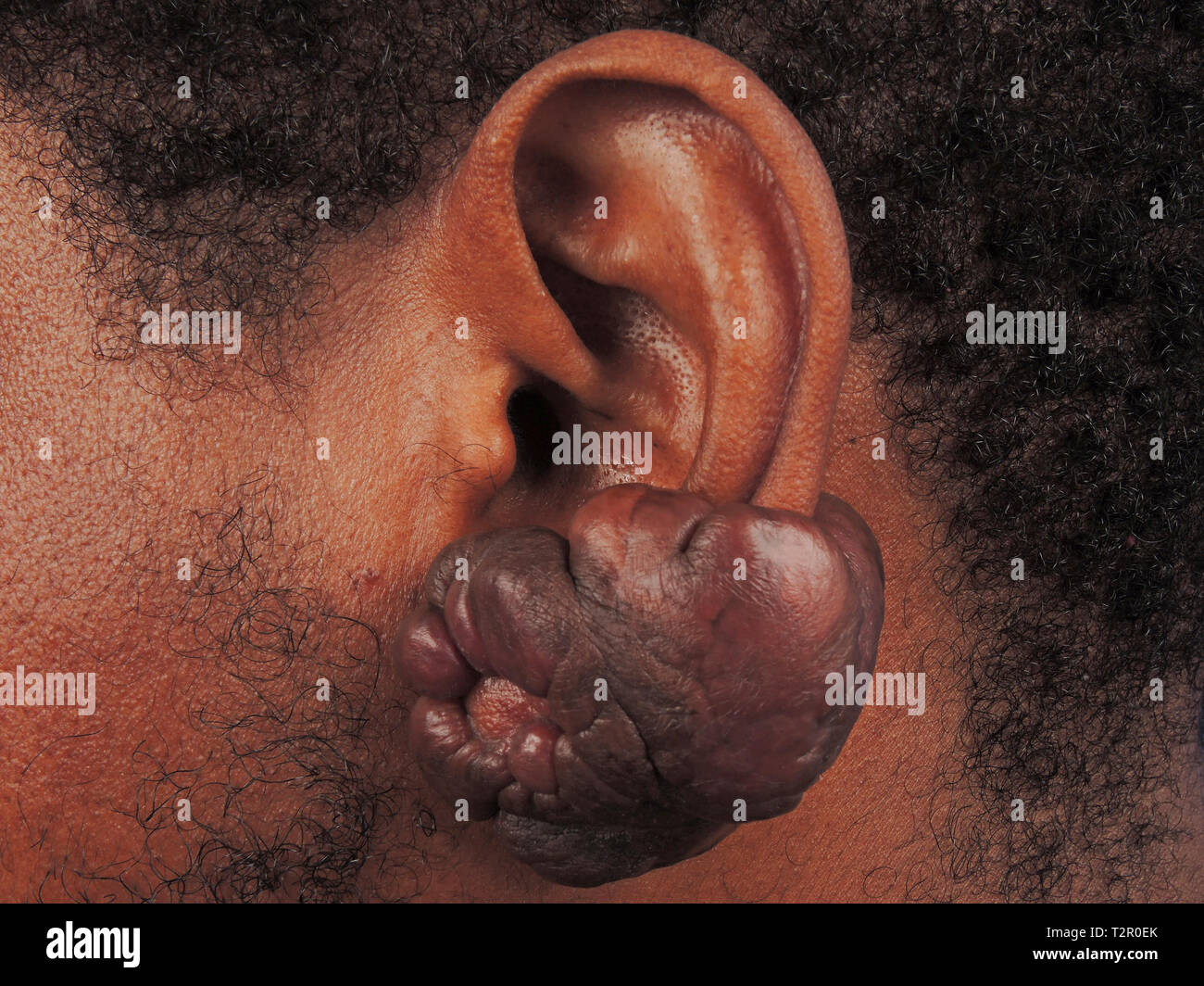 Ear Stock Photo