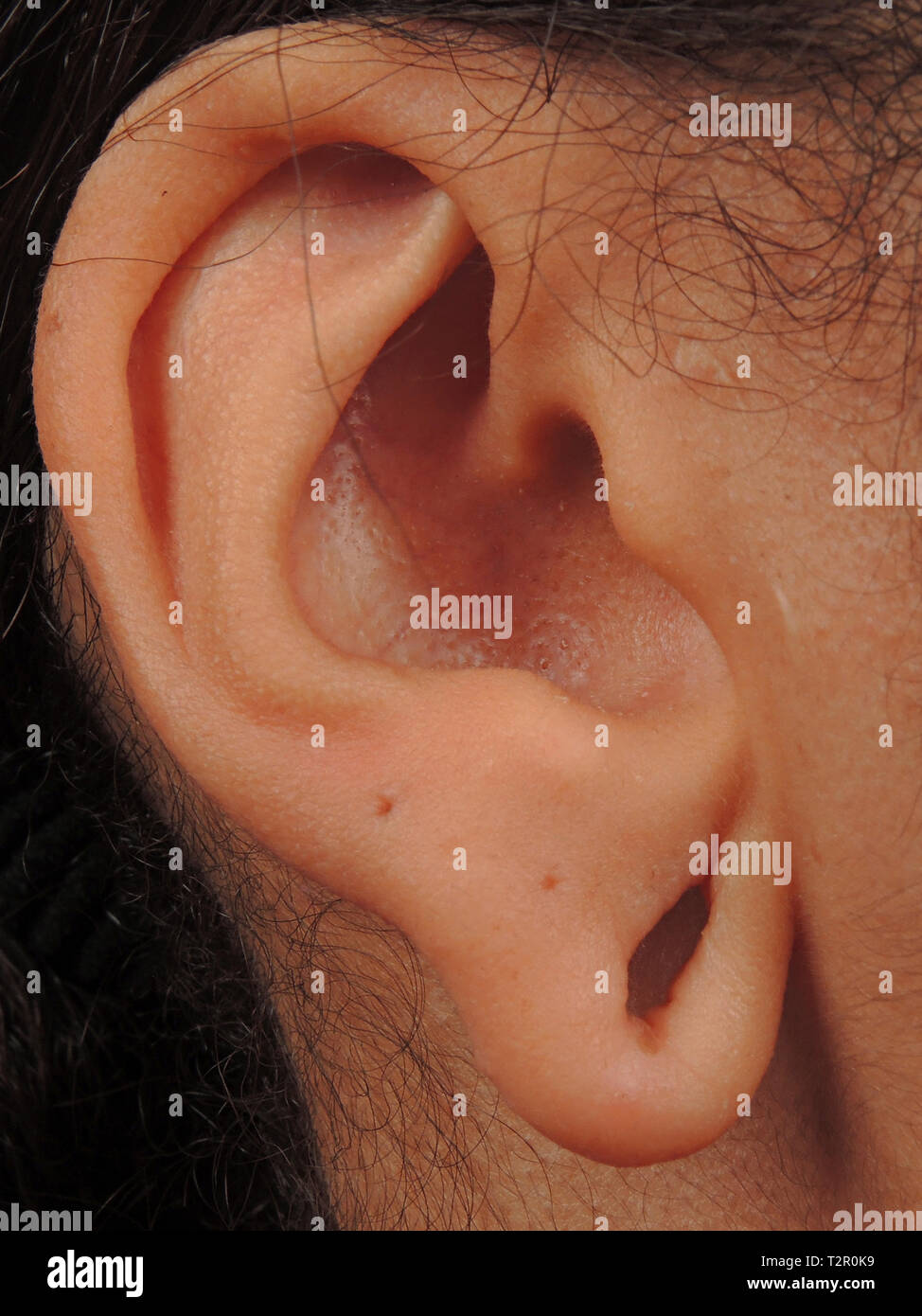 Ear Stock Photo