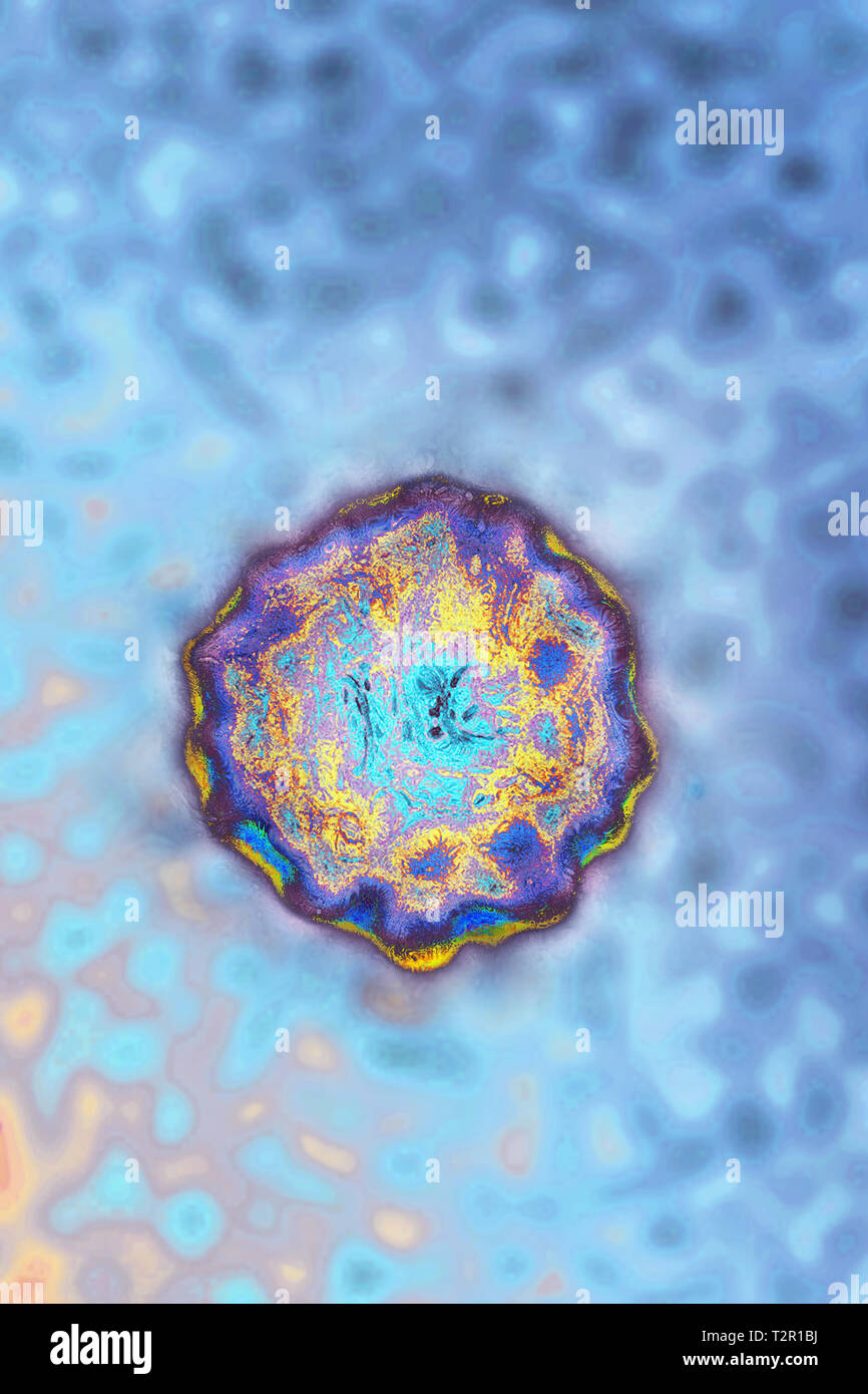 Hepatitis A virus Stock Photo