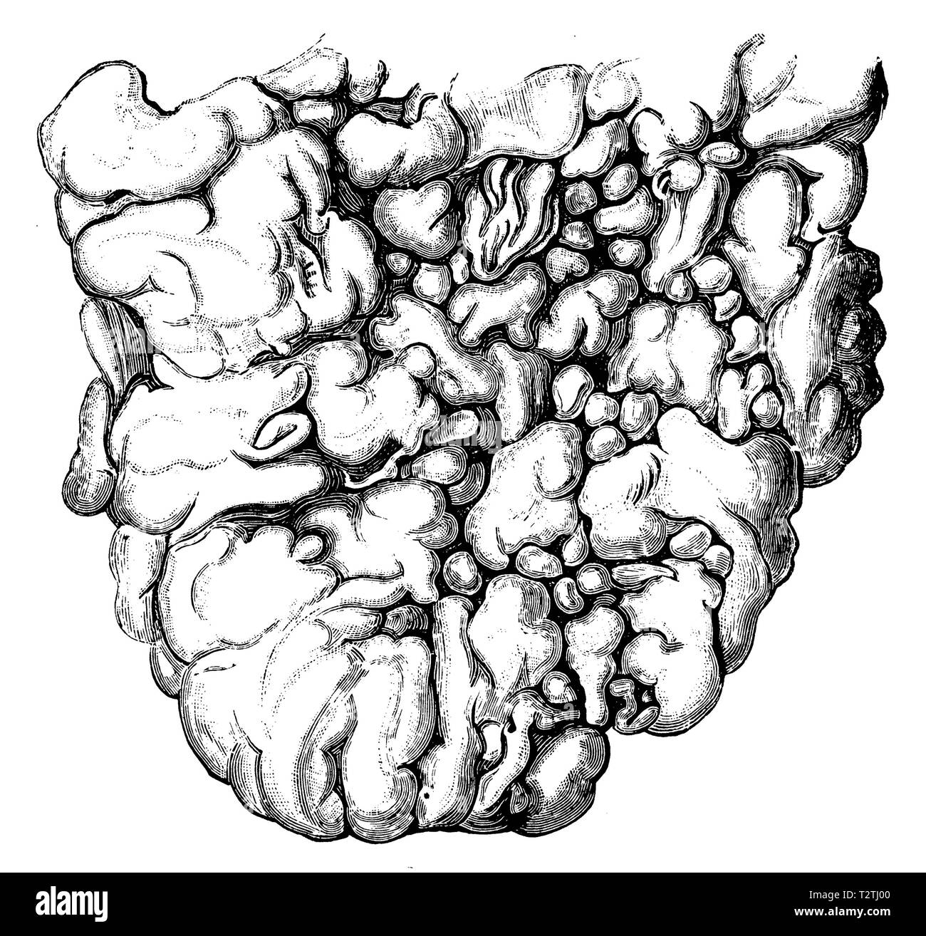 Tuberculous pleura of a cow. After Ziegler,   1905 Stock Photo