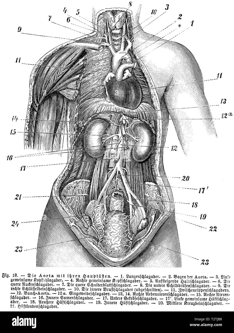 Human: aorta with its main branches, 1) pulmonary artery, 2) arch of aorta, 3) left common carotid artery, 4) right common carotid artery, 5) ascending carotid artery, 6) transverse carotid artery, 7) transverse scapula, 8) lower thyroid artery, 9 ) Right coronary artery, 10) Internal thoracic aorta (truncated), 11) Intercostal veins, 12) Abdominal aorta, 12 a) Intestinal staph, 13, 14) Right adrenal artery, 15) Right renal artery, 16) Internal seminal vein, 17) Lower mesentery artery, 17 ') Left common hip artery, 18) Outer hip artery, 19) Internal hip artery, 20) Mid-sacral artery, 21) Hip a Stock Photo