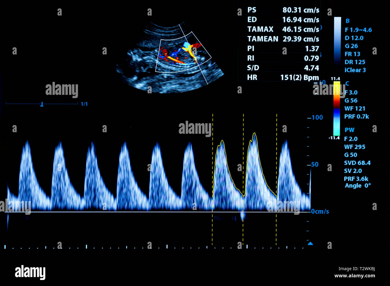 Colourful image of modern ultrasound monitor. Ultrasonography machine