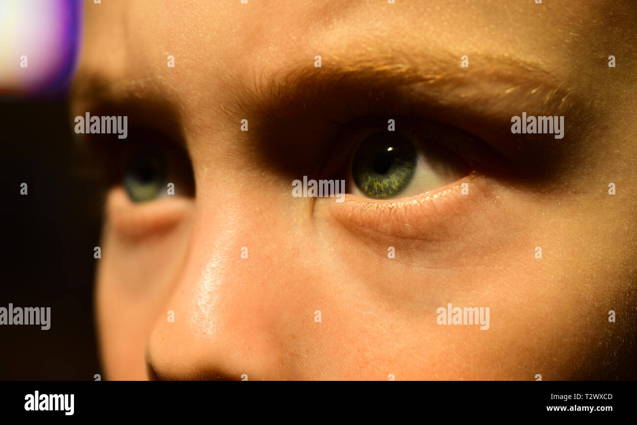 Loosing my eyesight. Small boy wear contact lens. Little boy with poor